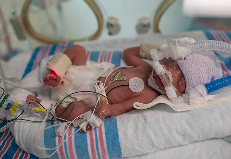 While newborn babies are in hospital, they need to be continuously monitored including measurement of their heart rate and blood oxygen levels.
